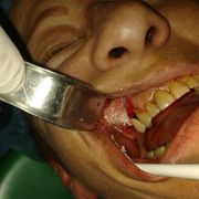 Clínica Dental Dr. Presencia Martí persona en consulta dental