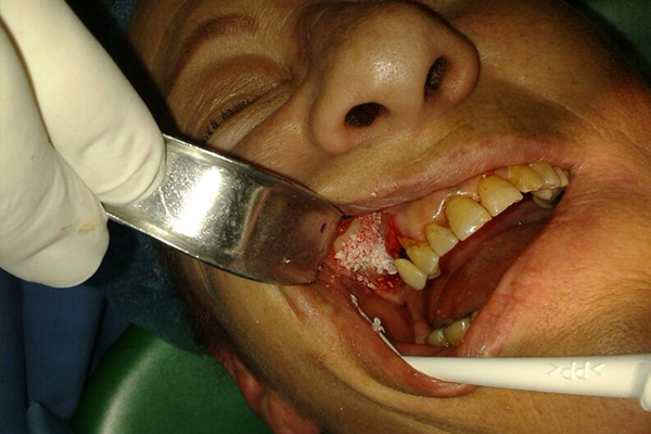 Clínica Dental Dr. Presencia Martí persona en consulta dental