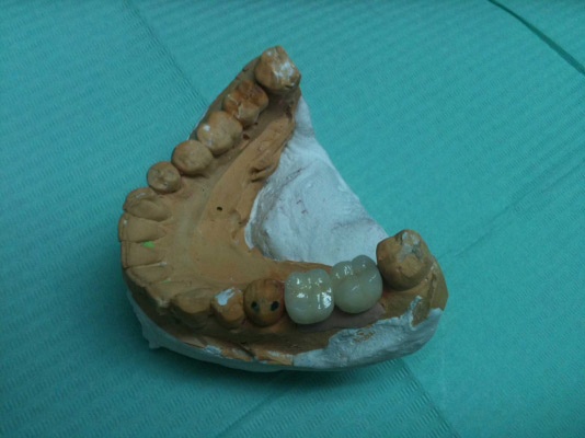 Clínica Dental Dr. Presencia Martí molde
