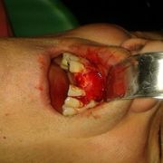Clínica Dental Dr. Presencia Martí persona recibiendo procedimiento dental
